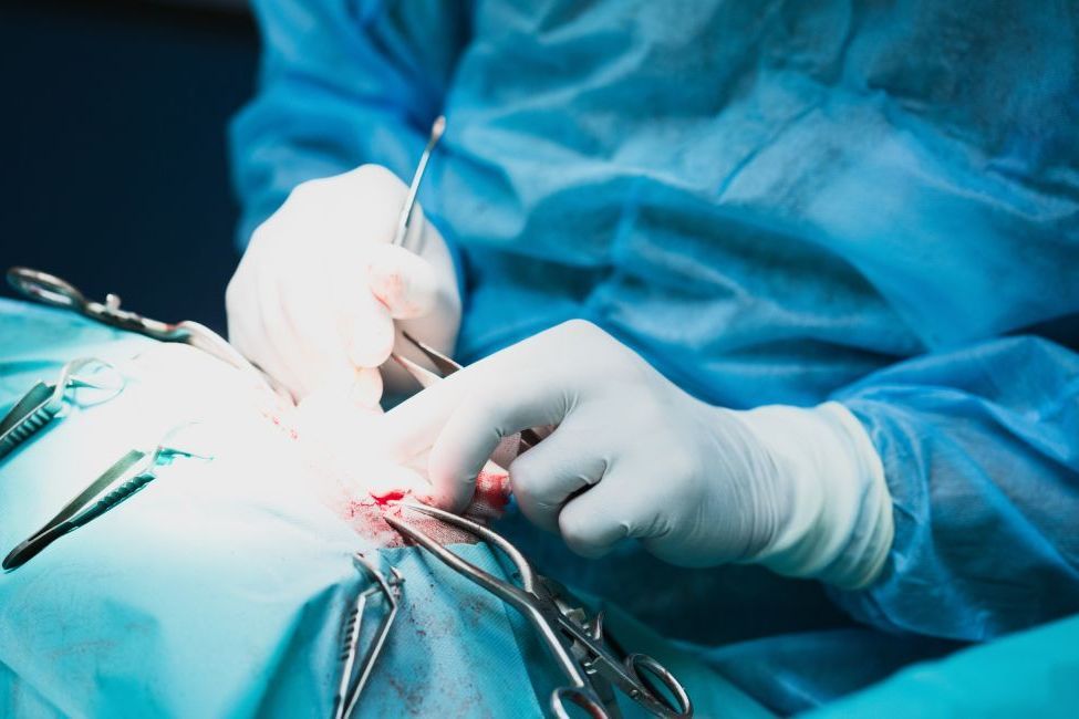 Operation